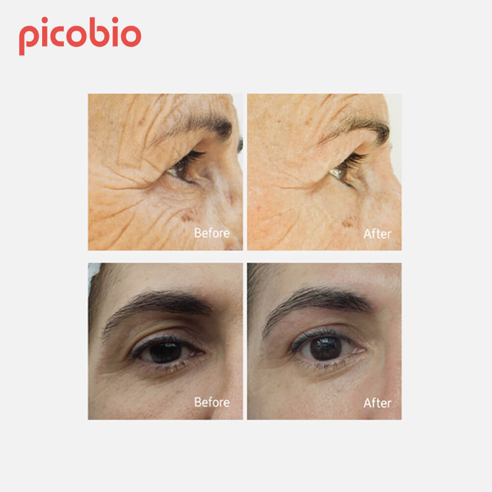Picobio_Pepplus_Special-Skin-Care-Lifting-Program_13